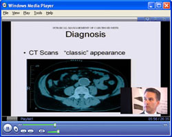 webcast recording with picture-in-picture, click to view